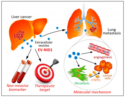 A research team at LKS Faculty of Medicine, The University of Hong Kong (HKUMed) discovered that the liver cancer cell-derived extracellular vesicles (EVs) promote tumour growth and metastasis to lungs. The novel findings of the tumour-derived extracellular vesicles provide insights into promising biomarker and new therapeutic approach for liver cancer.