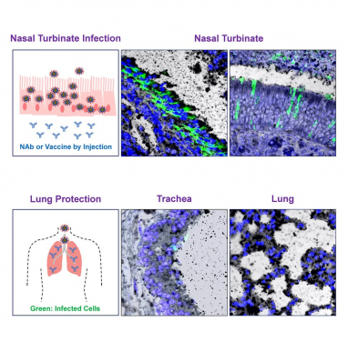 HKUMed research team reveals that while systemic HuNAb suppresses SARS-CoV-2 replication and injury in lungs, robust viral infection in the nasal turbinate may help the virus to evade antibody and therefore contribute to subprotection and reinfection. This finding not only reveals a mechanism underlying the difficulty of full protection against asymptomatic infection, but also highlights the importance of COVID-19 mucosal vaccine development.