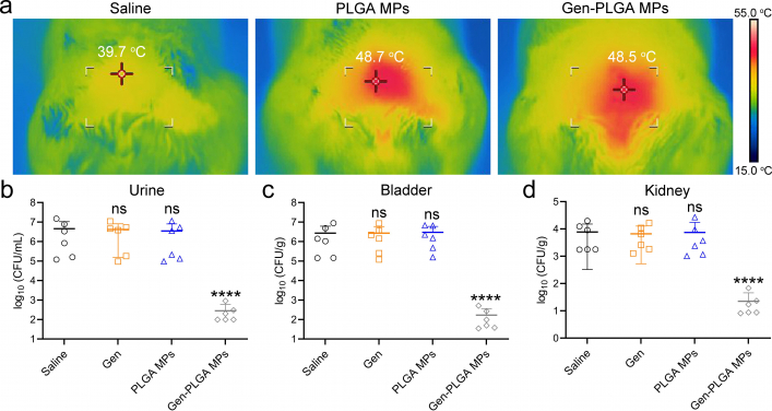 Treatment efficacy:Urinary tract infection: a) Thermal images indicating the skin temperature over the bladder after injection with saline, PLGA microparticles (MPs), and gentamicin-loaded PLGA MPs (Gen-PLGA MPs), and microwave hyperthermal (MWH) irradiation for 10 minutes. b–d) MDR E. coli bacterial burden in b) urine, c) the bladders, and d) the kidneys after different interventions. It’s obvious that the group of gentamicin-loaded PLGA MPs after MWH can significantly reduce the bacterial load as compared with other groups.