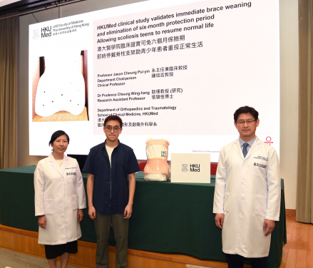 HKUMed has conducted the largest clinical trial on brace weaning to date, revealing that immediate brace removal is the preferred strategy for patients with adolescent idiopathic scoliosis (AIS) once skeletal development is mature. This finding provides effective evidence to cancel the current standard protection period. Pictured (from left) are Dr Prudence Cheung Wing-hang, a former AIS patient Mr Yiu, and Professor Jason Cheung Pui-yin.