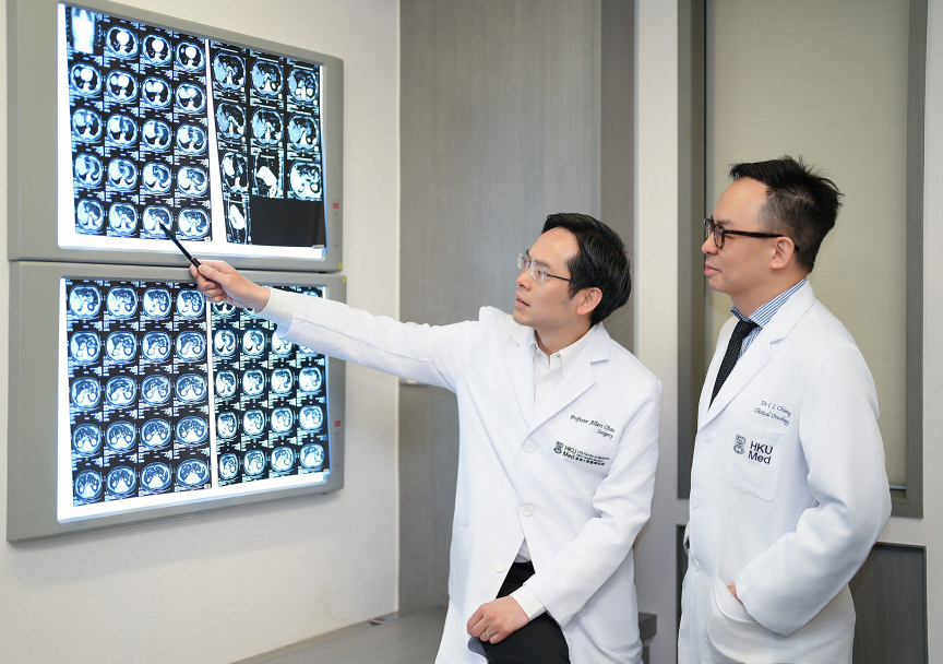 港大醫學院創新療法成效顯著 46%中晚期肝癌患者無需手術達到完全控制